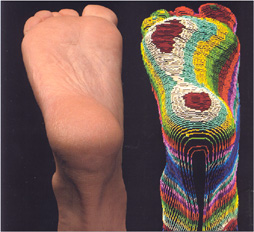 foot orthotics